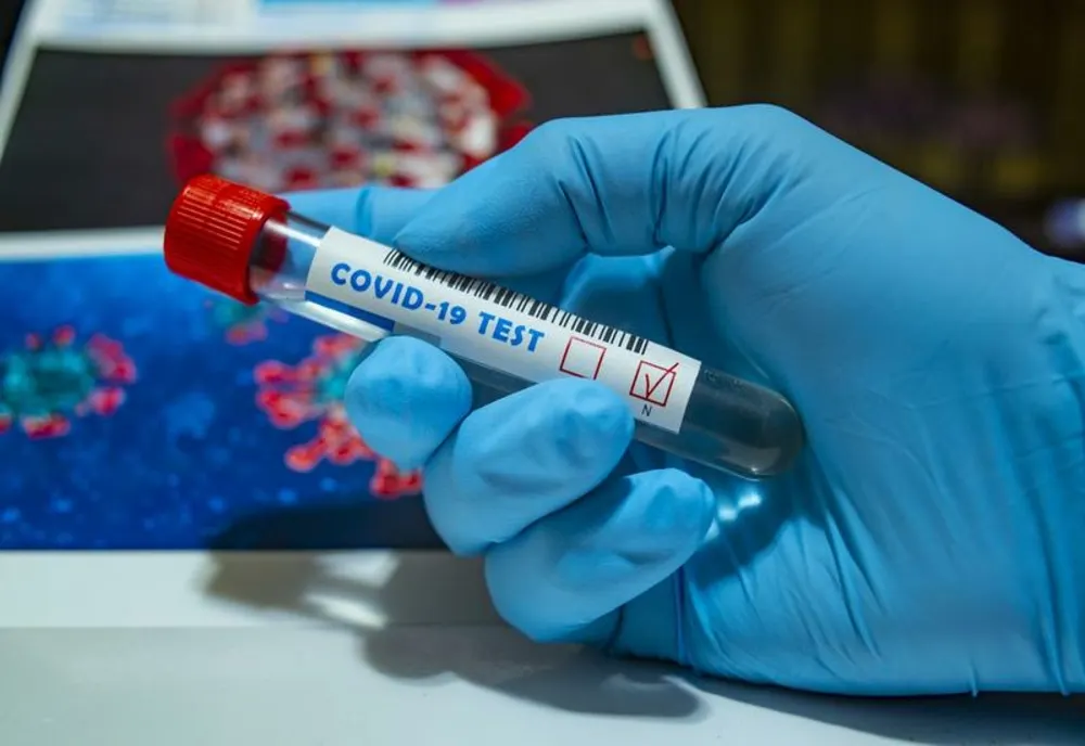 Bilanț coronavirus: 17.158 de infectări și 423 de decese în ultimele 24 de ore