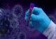 Bilanț coronavirus: 527 de cazuri noi de COVID-19, înregistrate în ultimele 24 de ore, cu 31 mai puţine decât în ziua precedentă