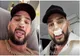 Cum arată nasul lui Dorian Popa după operație. Influencerul și-a dat bandajele jos